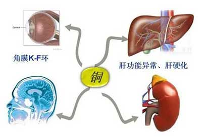 人体91香蕉视频精品数据能够准检测出但身体中微量元素铜超标会引起疾病发生 人体91香蕉视频精品数据能够准检测出但身体中微量元素铜超标会引起疾病发生